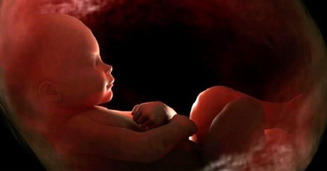 Meconium Amniotic Mayi (Baby pooping in the womb)