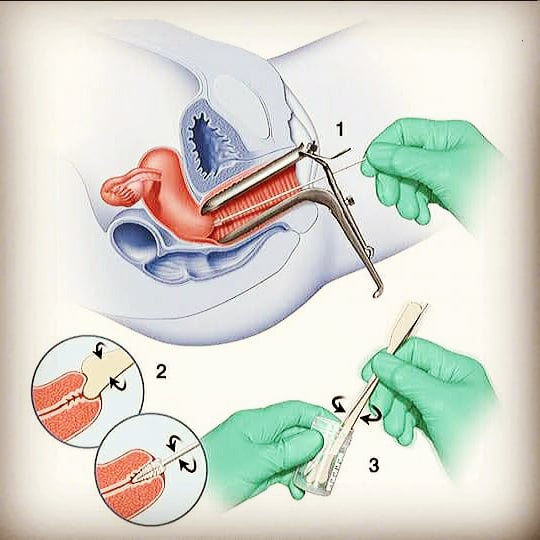 SMEAR TEST