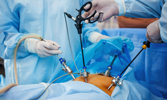 Overview of Laparoscopy